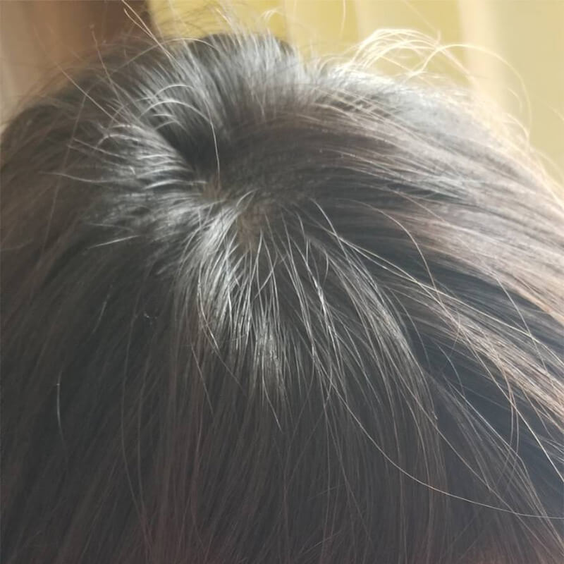 薄毛頭のてっぺん