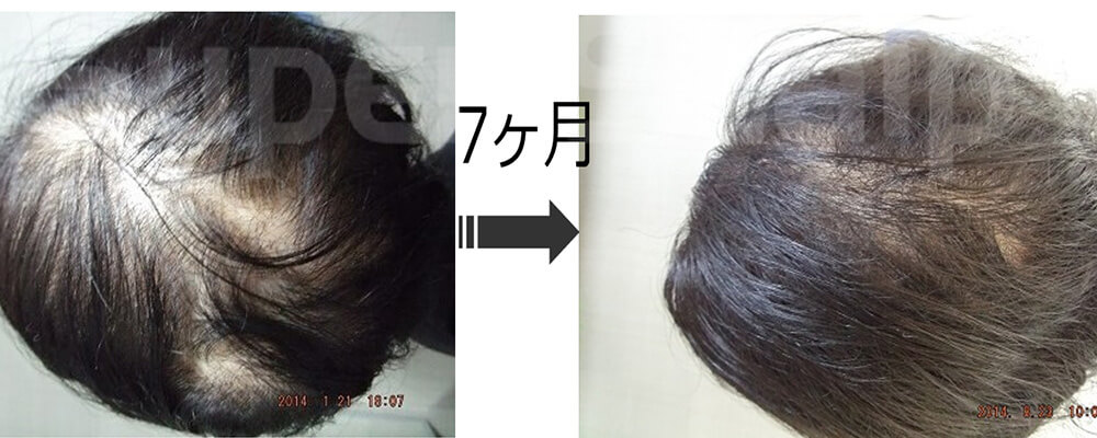 スライダー画像3