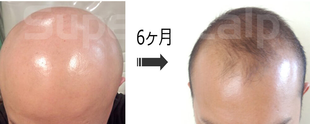 スライダー画像3