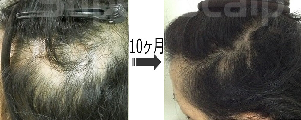 スライダー画像1