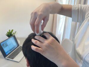 マイクロスコープで頭皮チェック